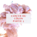 Cancer Du Côlon : Qu’est-ce Que Le Cancer Colorectal ? Quels sont les Symptômes, Causes, Stades, diagnostique